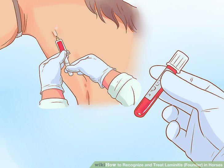 Step 13