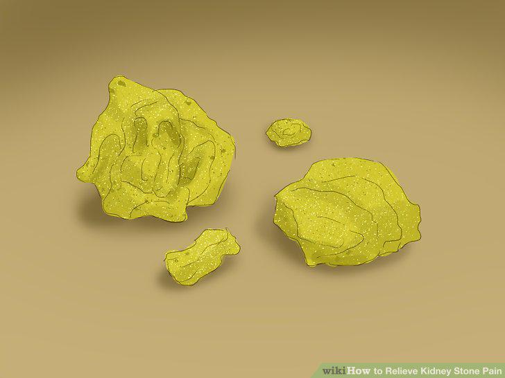 Step 10