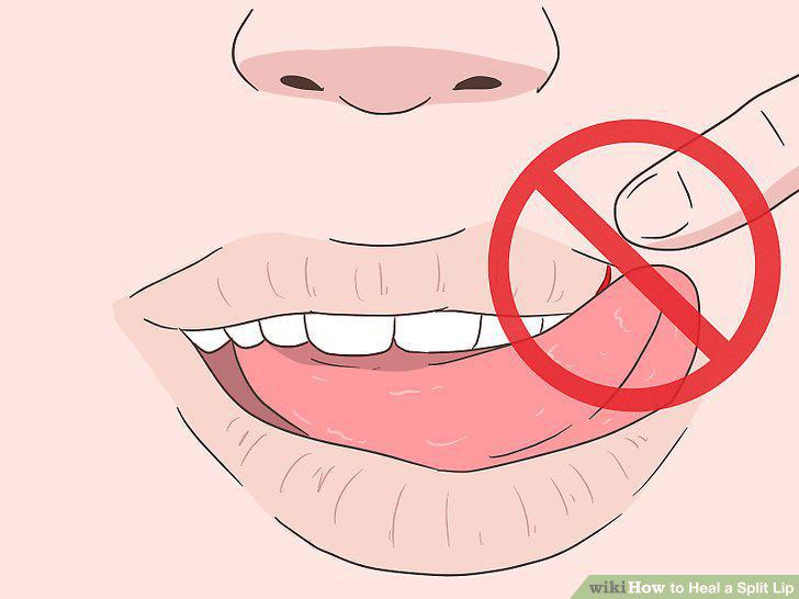 Step 11