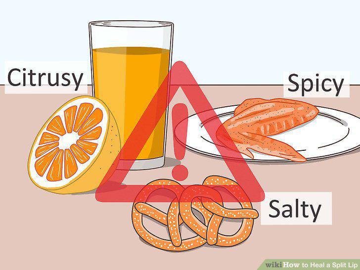 Step 10