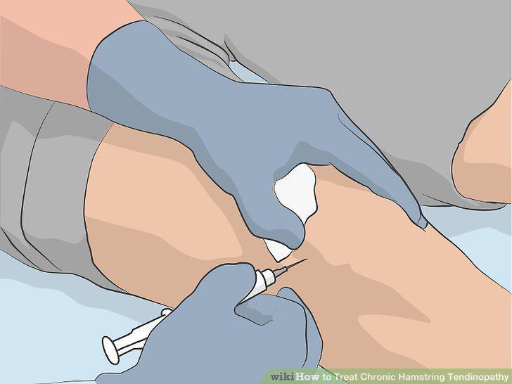 Step 14