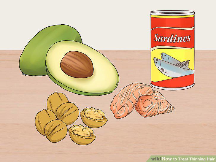 Step 14