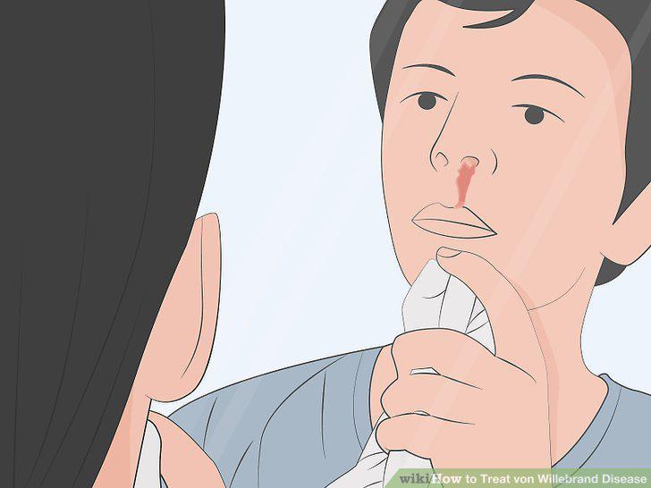Step 11