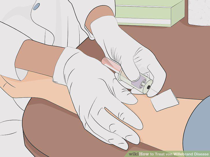 Step 13