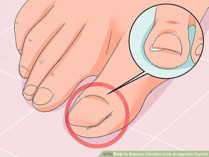 Step 2