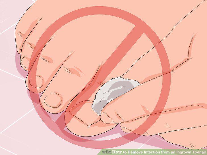 Step 9