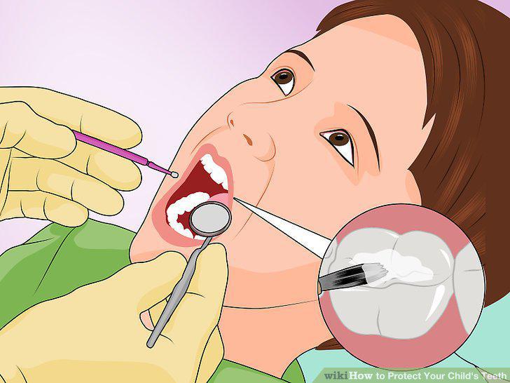 Step 14