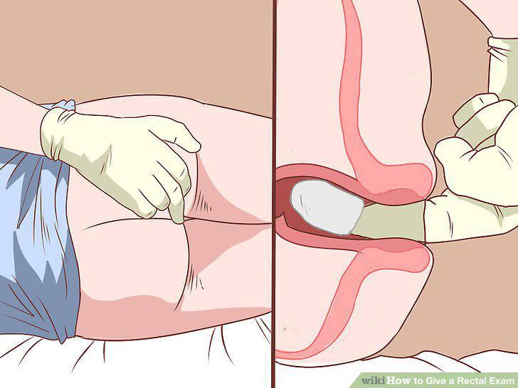 Step 6