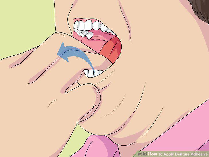 Step 13