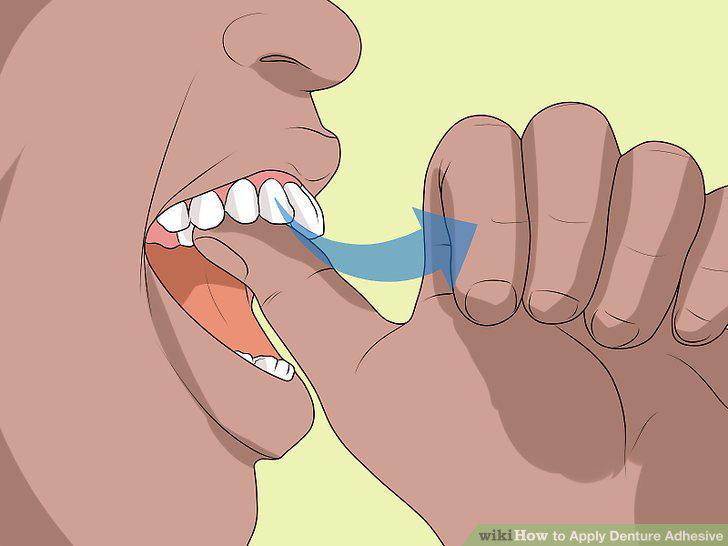 Step 14