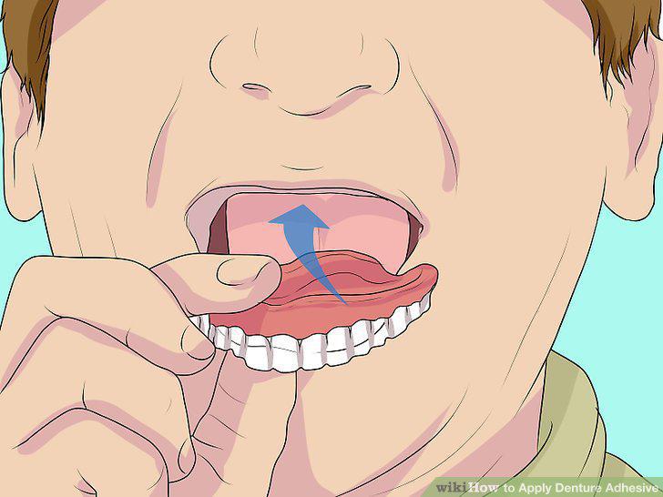 Step 10
