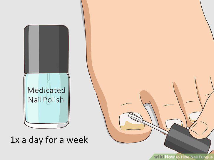 Step 13