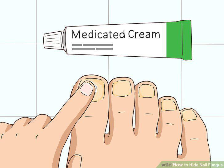 Step 14