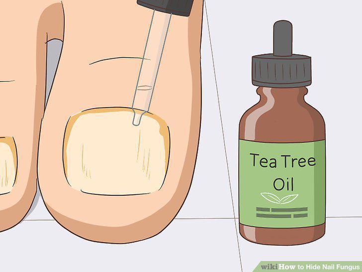 Step 15