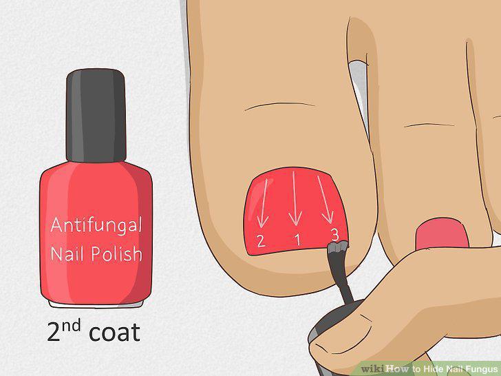 Step 5