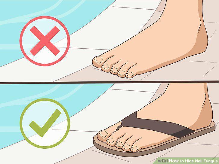 Step 10