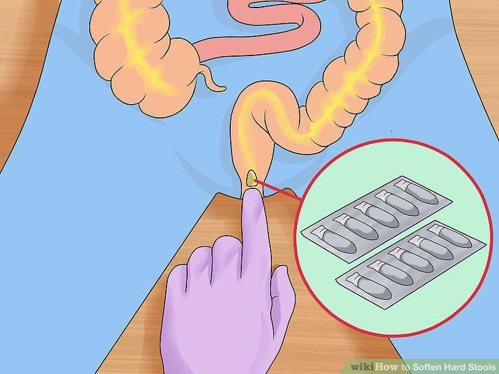 Step 18