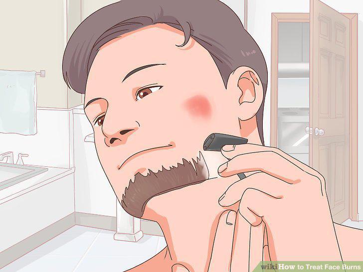 Step 14