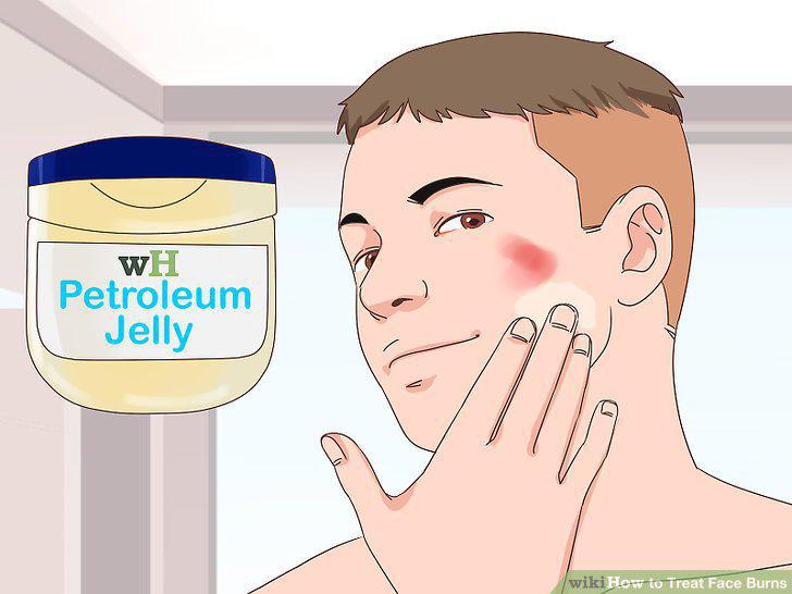 Step 15