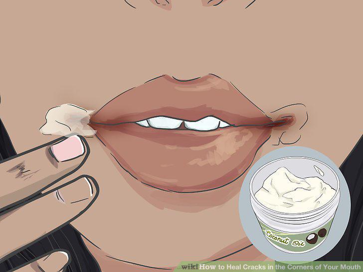 Step 2