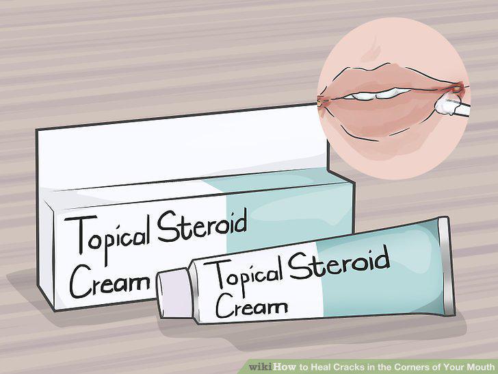 Step 10