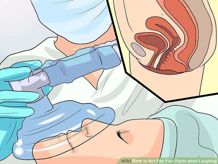 Step 14