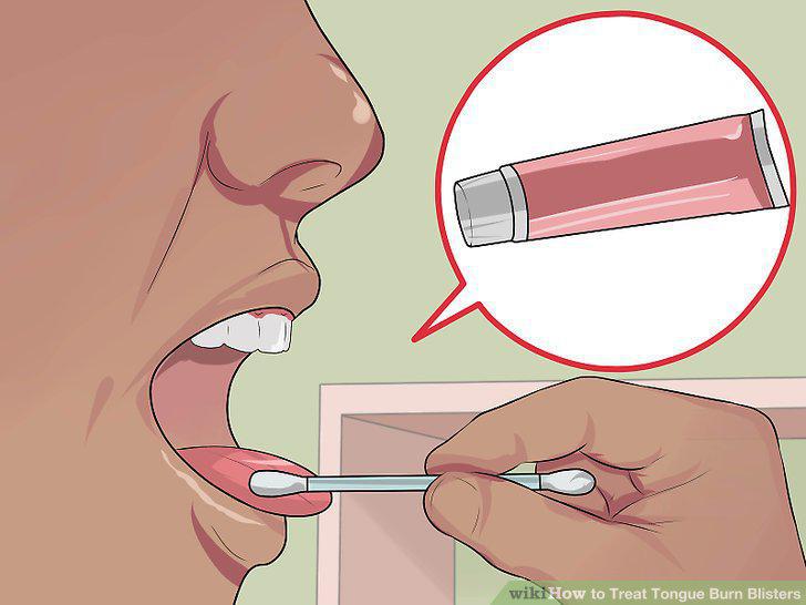 Step 11