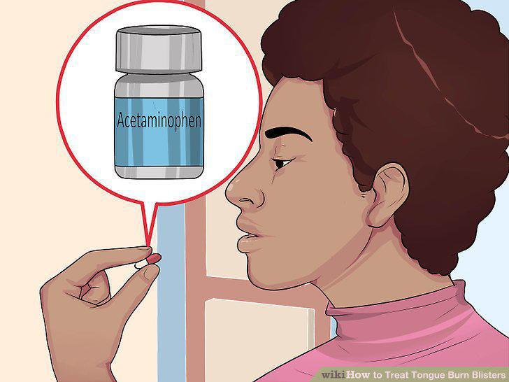 Step 12