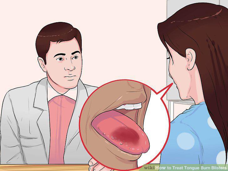 Step 14