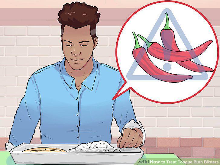 Step 17