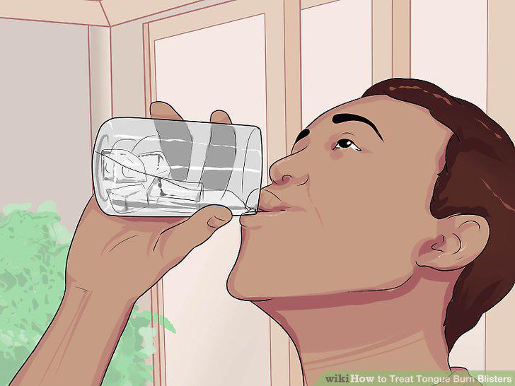 Step 9