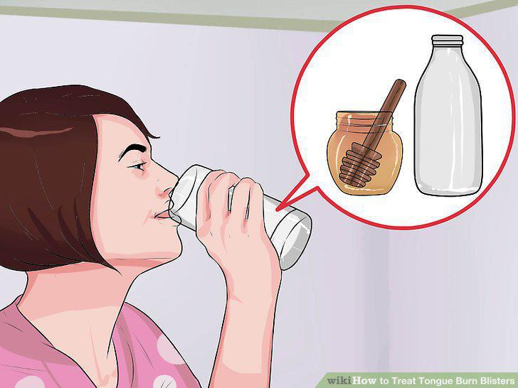 Step 10