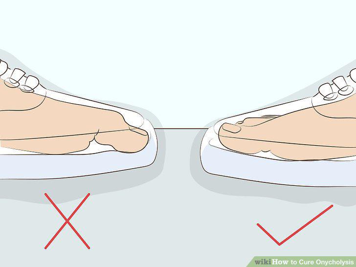 Step 12