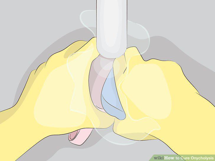 Step 14