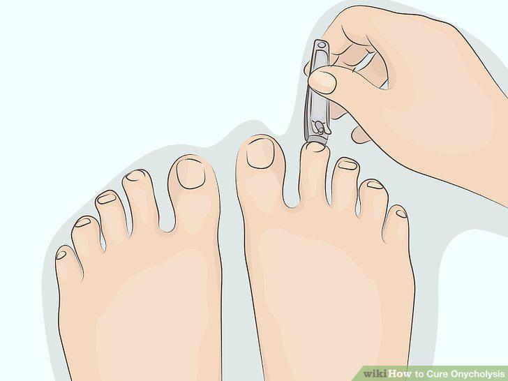 Step 15