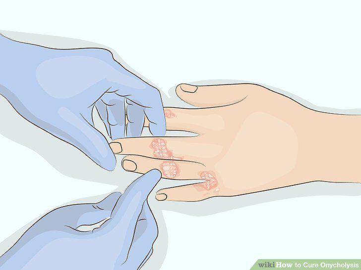 Step 3