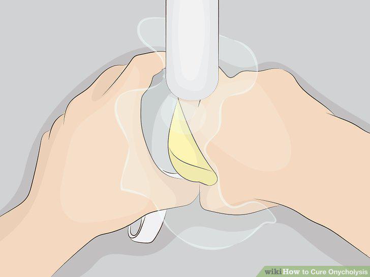 Step 5