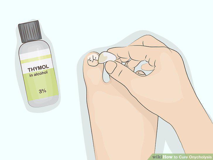 Step 10