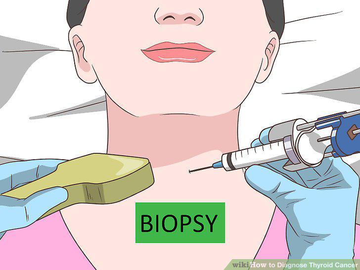 Step 10