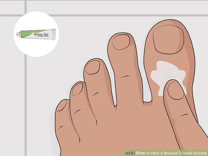 Step 11