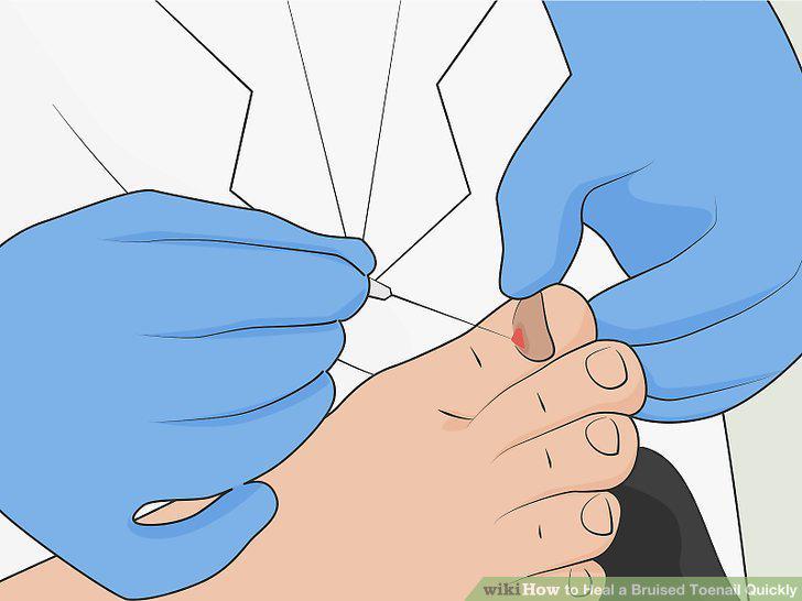 Step 13