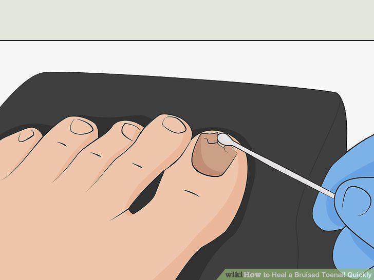 Step 14