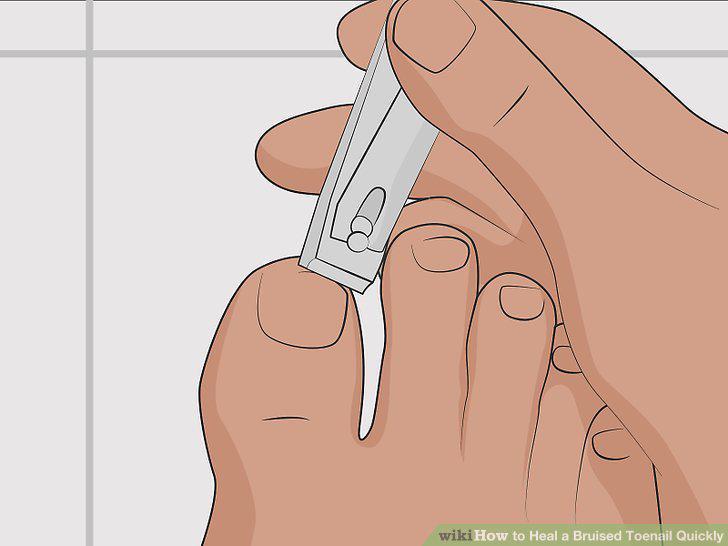 Step 16