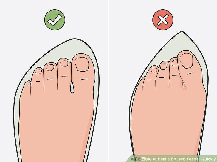 Step 17
