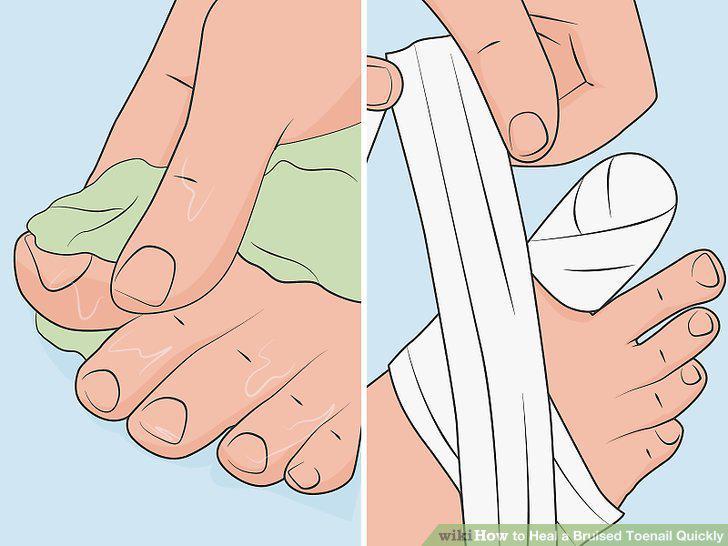 Step 7