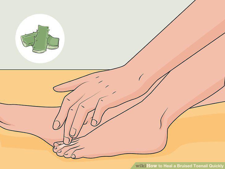 Step 10