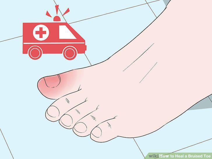 Step 12