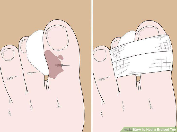 Step 5