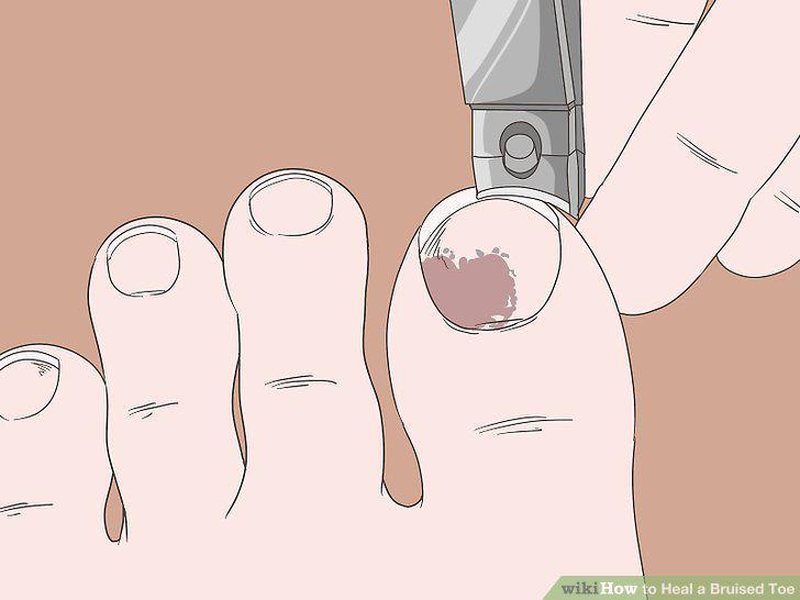 Step 10