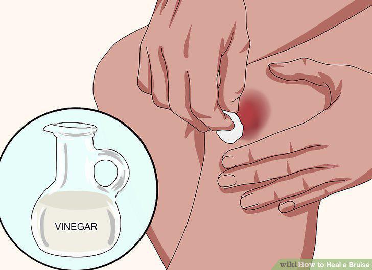 Step 8